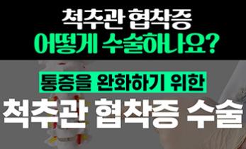 척추관 협착증 수술 어떻게 진행하나요?